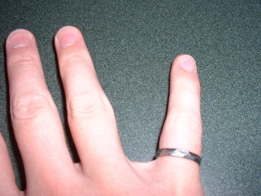 Finger with Ring